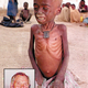 Nwangi Botusa, as photographed by a Children's Miracle Fund worker,
moments before dying of starvation. <b>Inset:</b> Merlin Olsen
